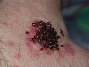 bedbugs_2D15_small