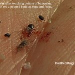 popped-bedbug-on-vee-150x150